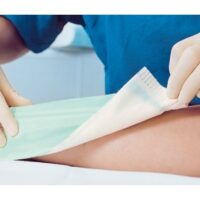 Zetuvit® Plus opatrunek z superabsorbentem (SAP)