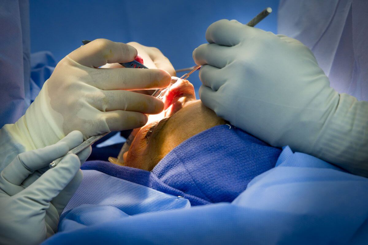 Chirurg otolaryngolog operuje nos