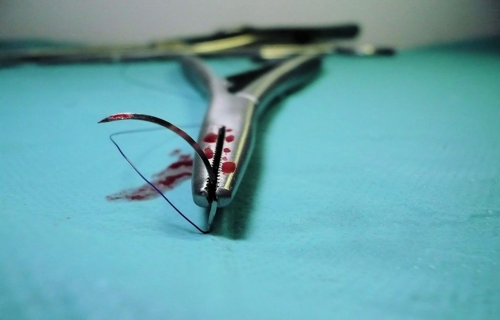 Igłotrzymacze służą do podtrzymywania igły w trakcie szycia chirurgicznego. U podstawy posiadają wygodny zatrzask. (Źródło: Pixabay.com, Autor: Dominik Karch)